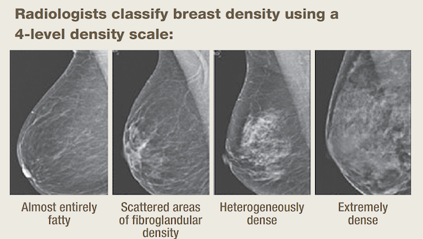 Breast density scale