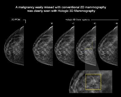 Schedule Your MRI at University Radiology Wall