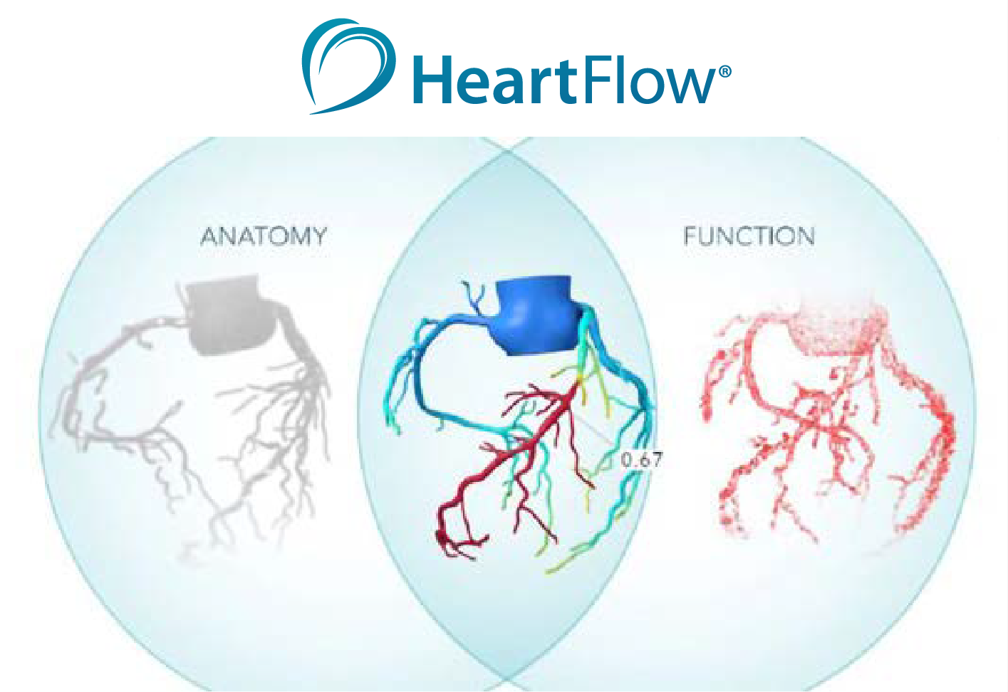 Heartflow diagram